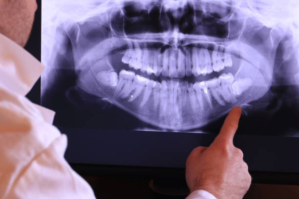 Best Cracked Tooth Emergency Dentist  in Campbell, FL