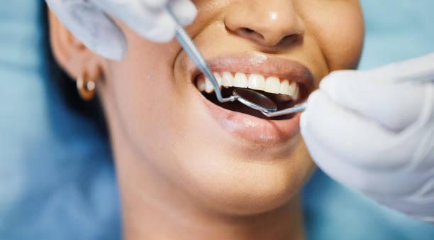 Best Emergency Gum Pain Relief  in Campbell, FL