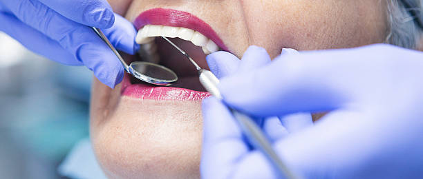 Best Cracked Tooth Emergency Dentist  in Campbell, FL